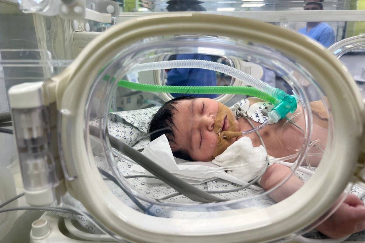 Bayi Mekah saat dalam perawatan inkubator di RS Abu Yousef al-Najjar, Rafah, Palestina.