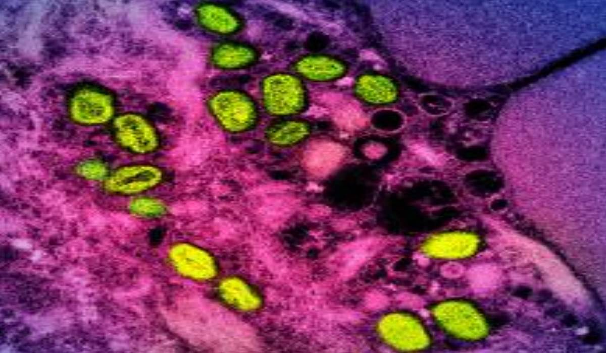 Mpox partikel yang diteliti di National Institute of Allergy and Infectious Diseases (NIAID) , Maryland, Amerika Serikat