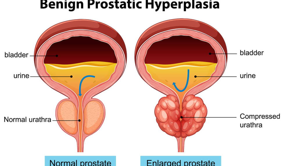 Yigit surati bilan etuk ayol