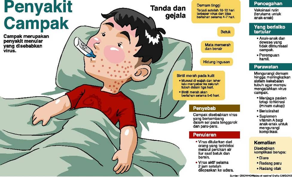 Jangan Sepelekan Begini Ciri-ciri Gejala Campak pada Anak